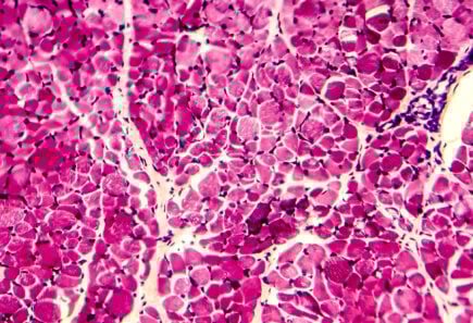 Micrograph of skeletal muscle