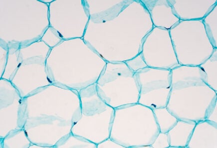 Cross sections of plant stem under microscope view show structure of parenchyma cells for education botany.